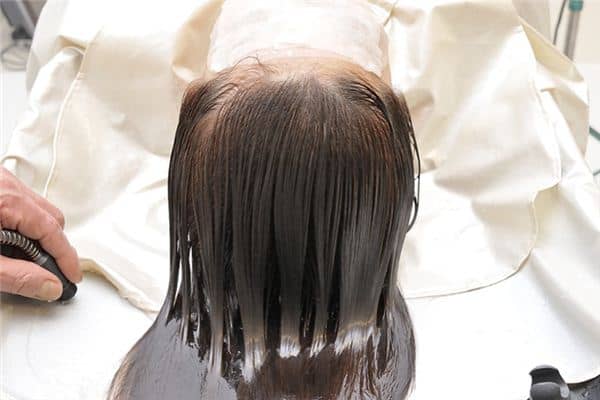 梦见头皮掉了是什么意思